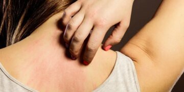 Массовая вспышка инфекции в школах Алчевска: оккупационные власти игнорируют угрозу