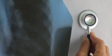 Київ під впливом небезпечних вірусів: динаміка захворюваності 