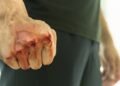 Напад серед білого дня у Києві: доньку відомого журналіста вдарили на зупинці