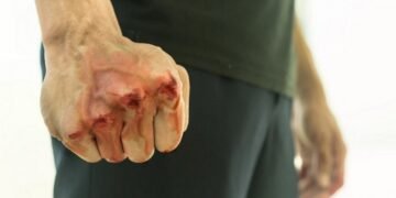 Напад серед білого дня у Києві: доньку відомого журналіста вдарили на зупинці